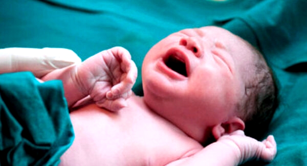 تولد نوزاد در شرایط ویژه: مادر با بیماری قلبی موفق به زایمان شد